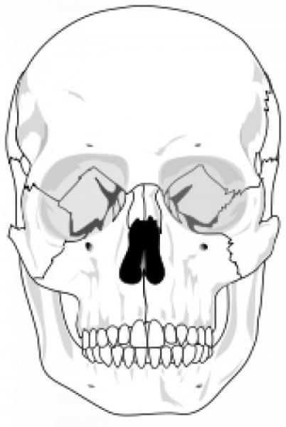 Imprimir Mapa Interactivo: señalar huesos (señalizacion - anatomía - huesos de la cara) Imprimir Mapa Interactivo: señalar huesos (señalizacion - anatomía - huesos de la cara)